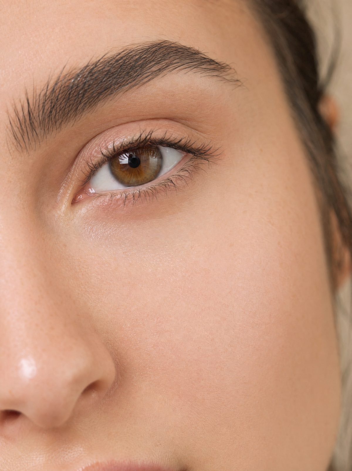 Tired & Hollow Under-Eyes treatment at DermaGlo Skin Clinic, Leeds